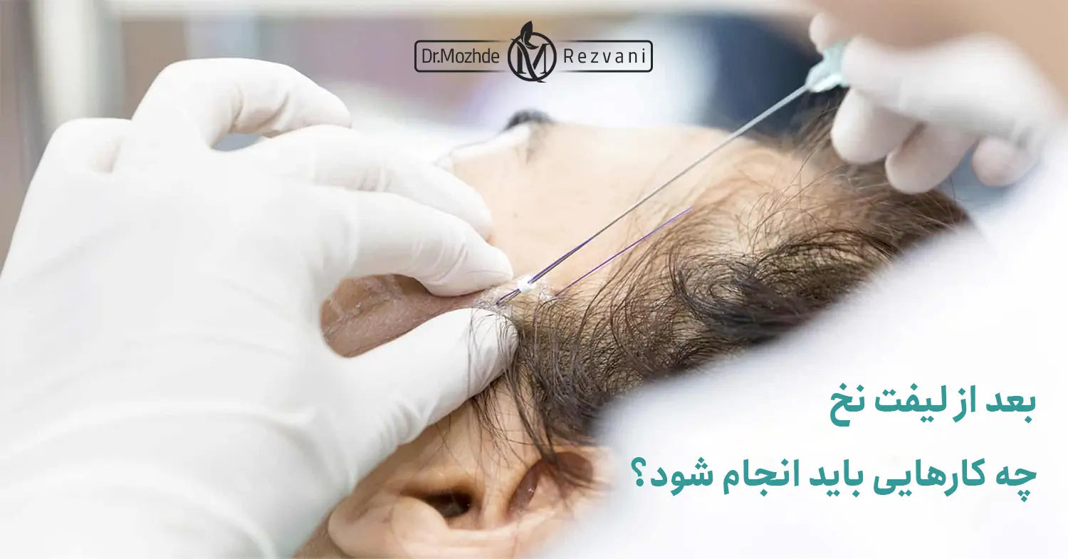 کارهایی که باید بعد از لیفت نخ انجام شود - مراقبت های بعد از لیفت نخ