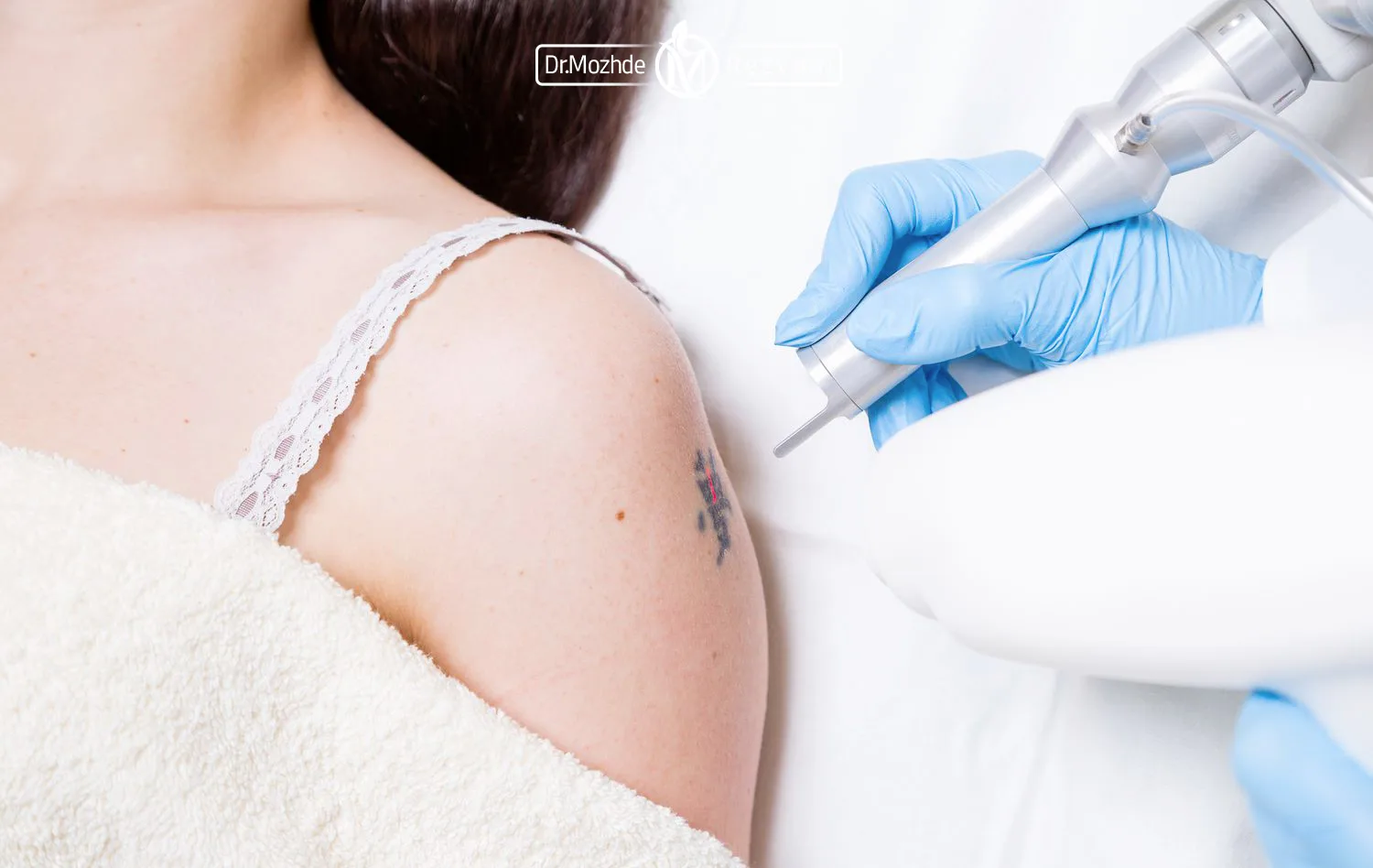 عکس هندپیس لیزر کیوسوئیچ در حال حذف تاتوی روی بازو مراجعه کننده زن