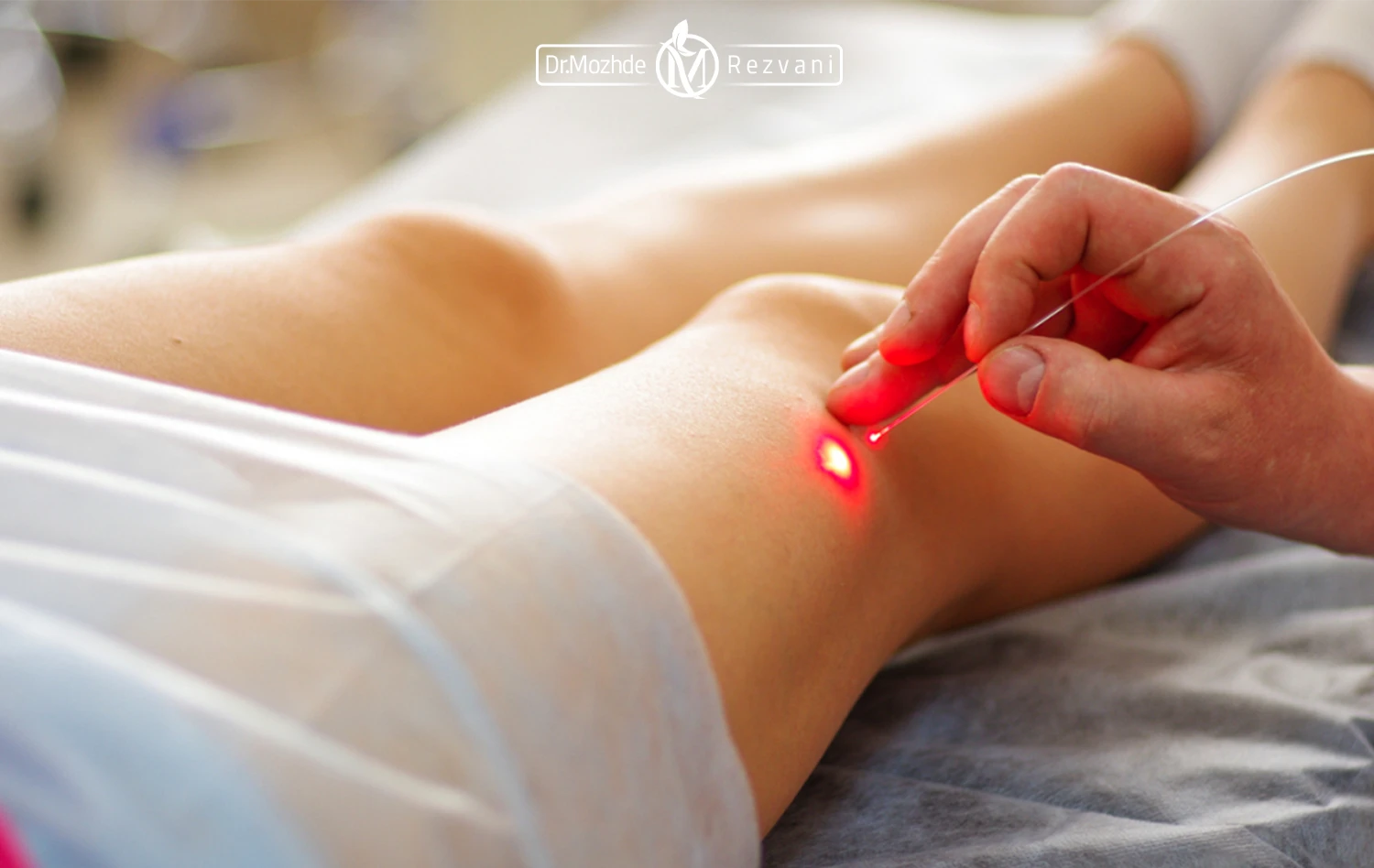 درمان رگ های واریس یک آقا با لیزر توسط پزشک متخصص