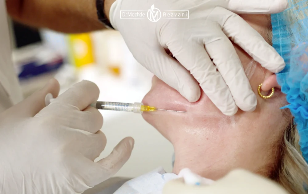 تزریق فیلر فک برای زیبایی جویی که روی تخت دراز کشیده است