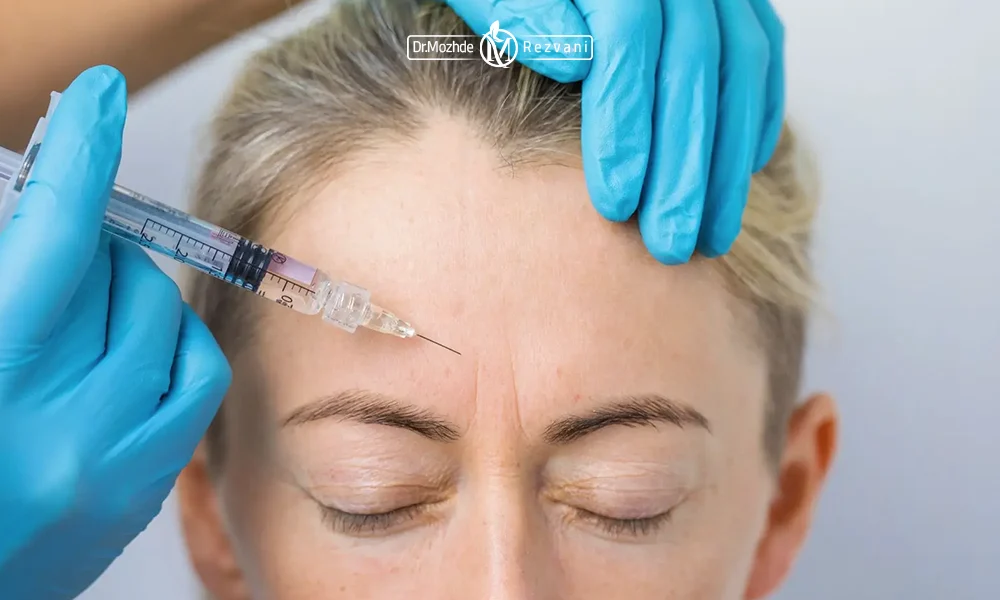 تزریق بین دو ابرو یک خانم از نقاط تزریق بوتاکس پیشانی