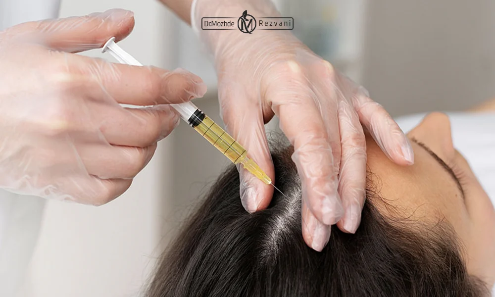 خانمی در حال تزریق مزوتراپی مو به پوست سر
