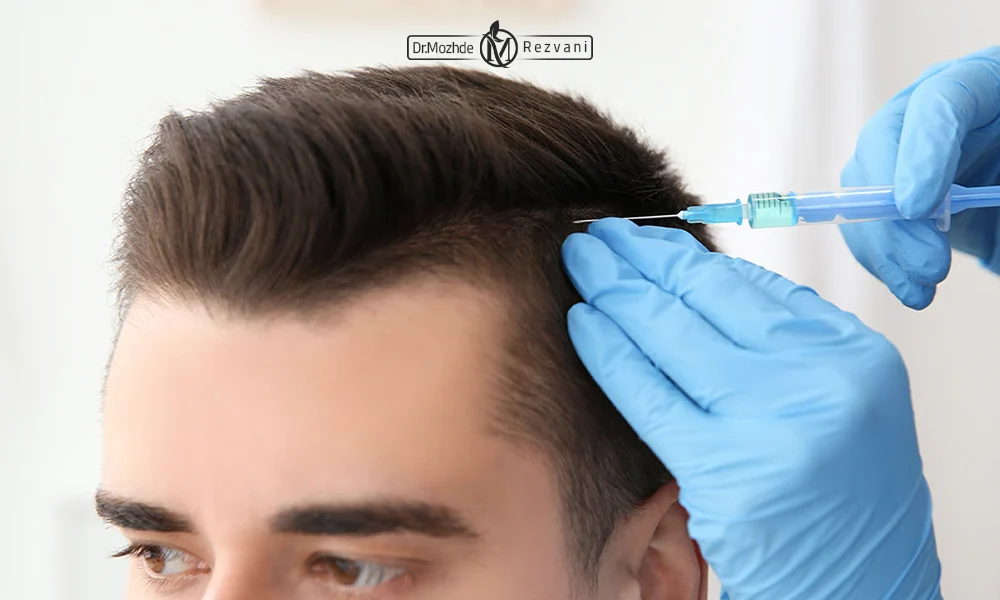 تزریق مزوتراپی مو برای یک اقا