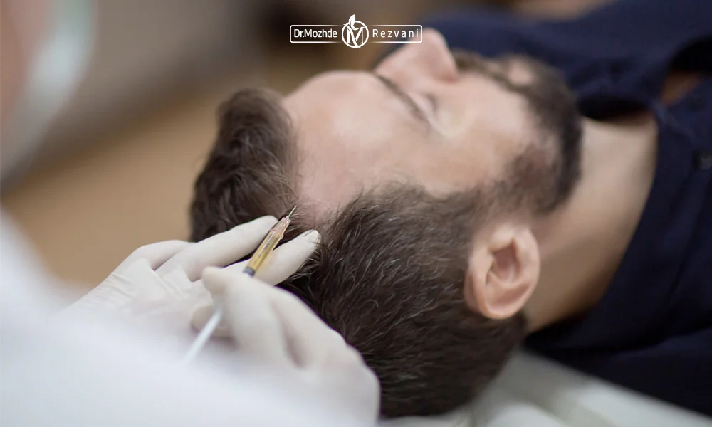 تزریق مزو مو سر یک آقا که ریزش مو دارد