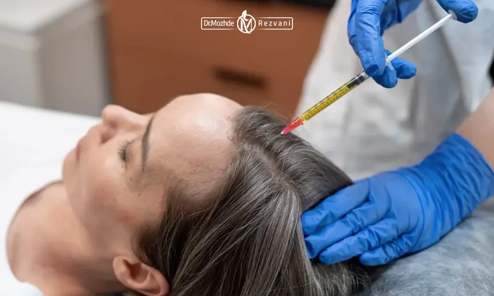 تزریق مزوتراپی مو به مو سر بیمار