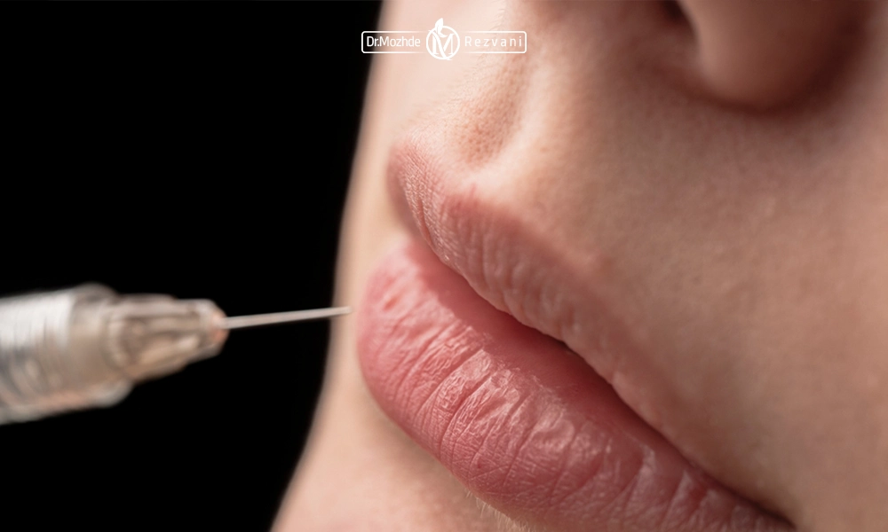 ژل لب طبیعی یا کلاسیک