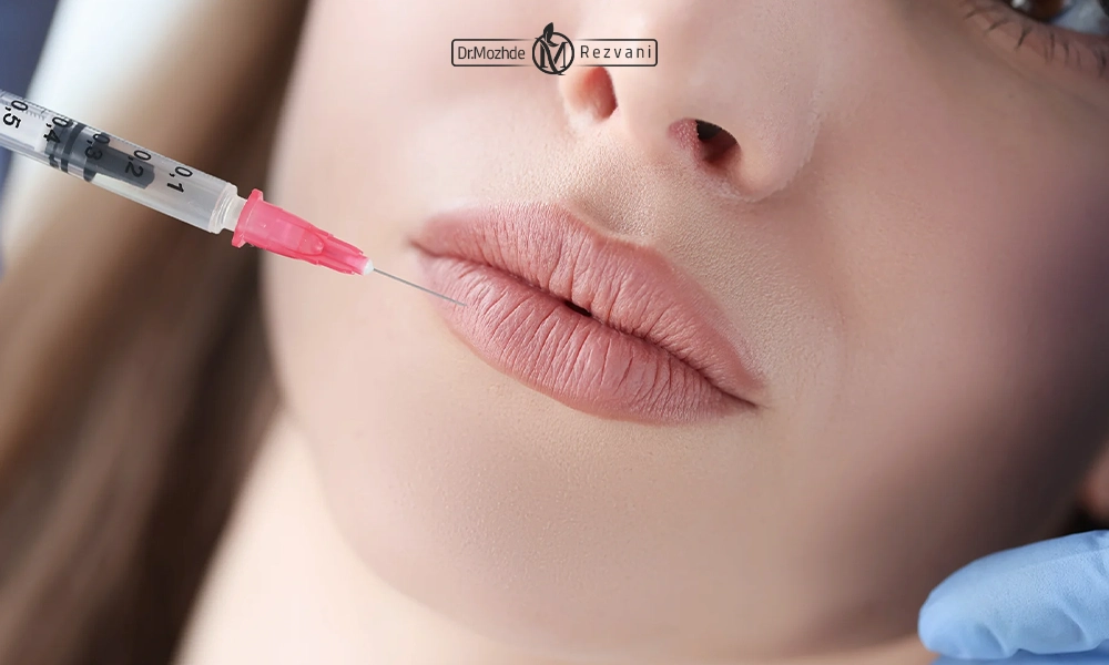 خانمی که تزریق ژل لب روسی انجام داده است