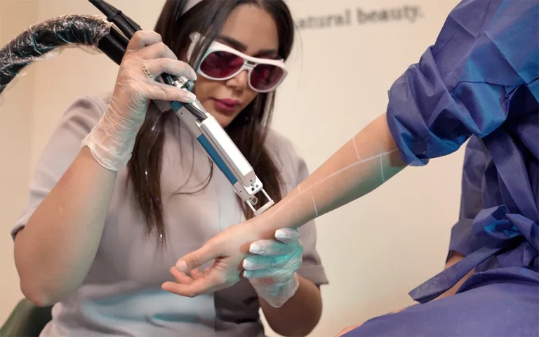 laser hair removal session on woman's wrist in Dr. Rezvani clinic