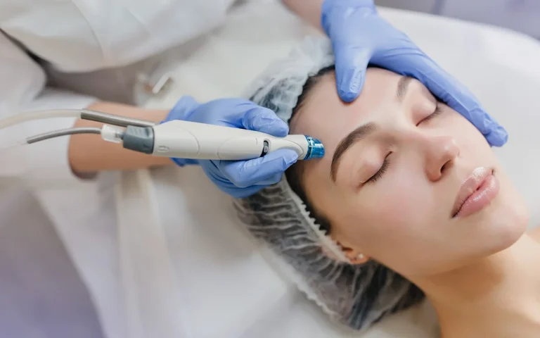 picture of microneedling being performed on woman's face