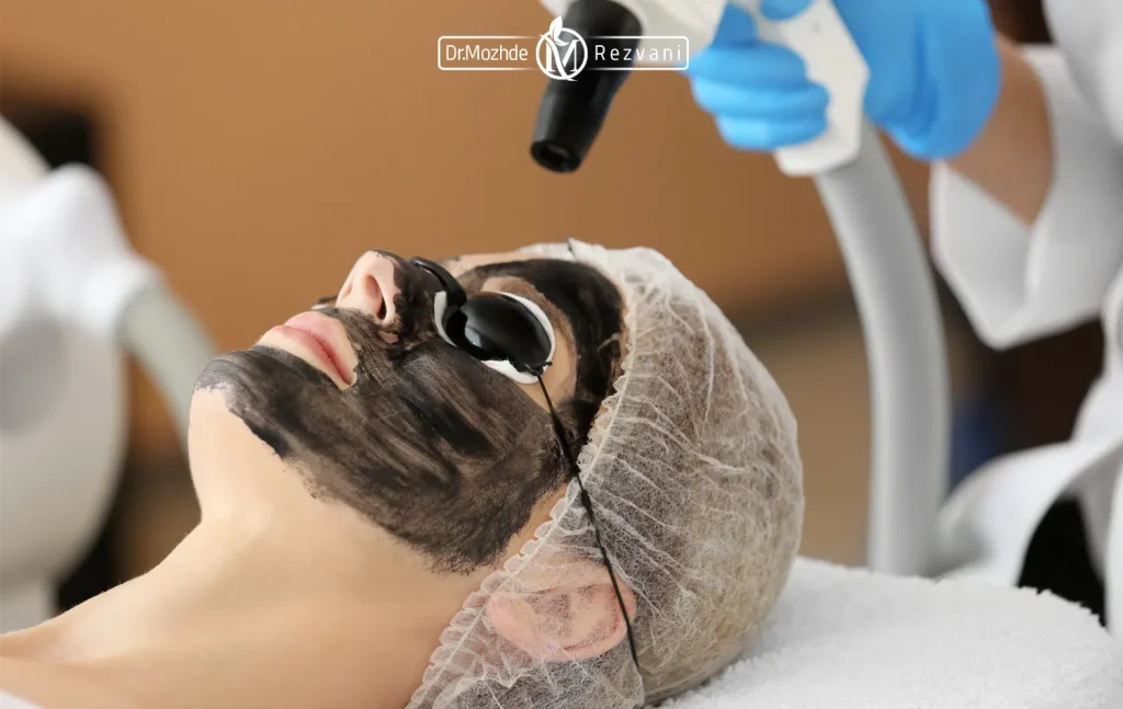 پزشک در حال انجام کربن درمانی بر روی صورت مراجعه کننده - کربن تراپی