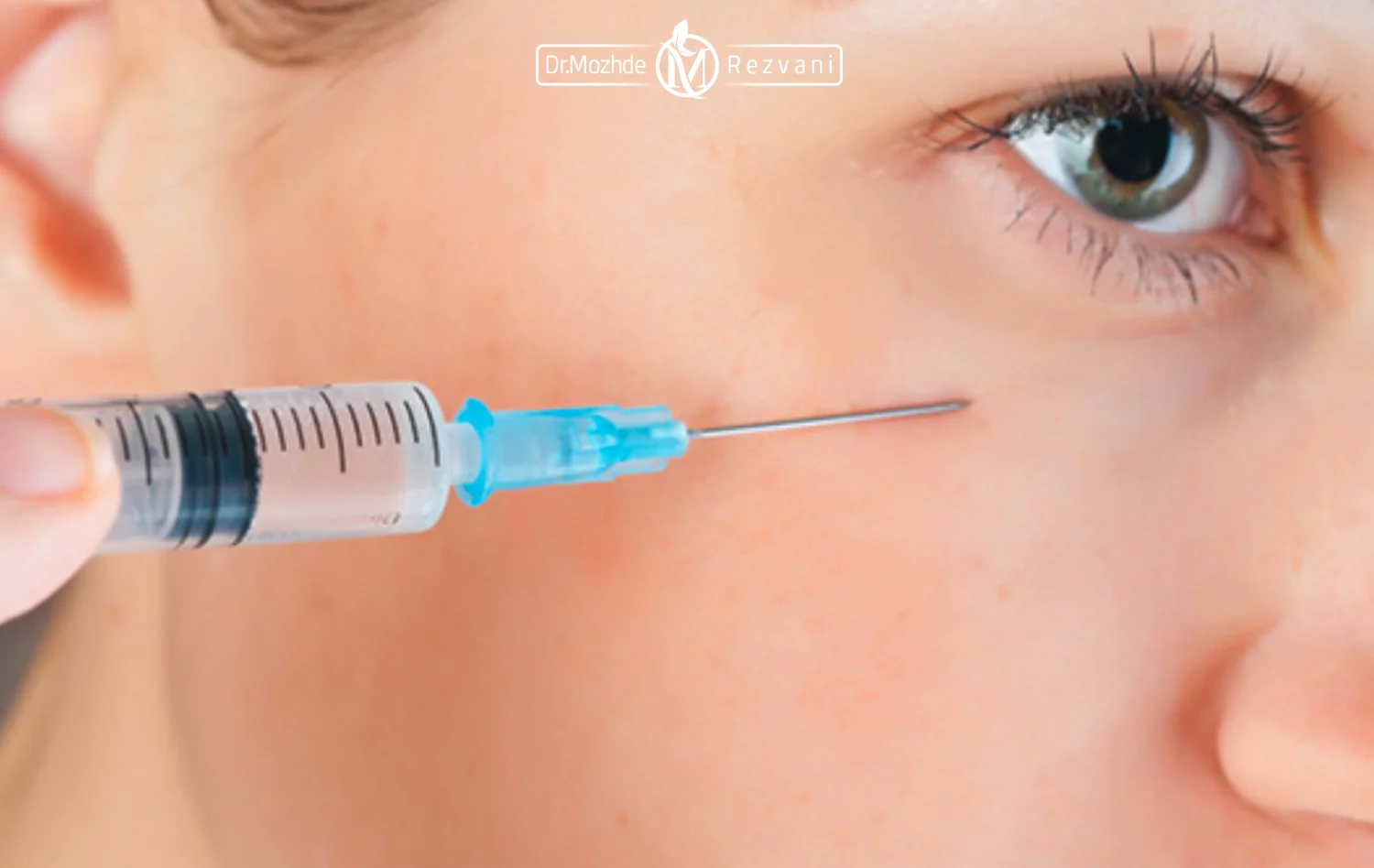 تزریق بوتاکس گونه برای ایجاد کات گونه روی صورت یک زیباجو