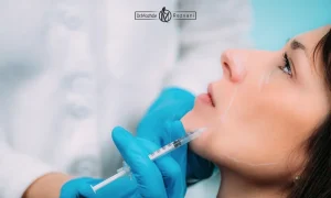 ورم بعد از تزریق فیلر گونه