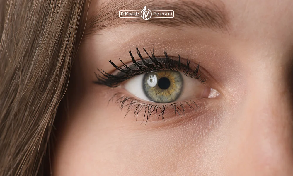 راه های درمان چروک دور چشم