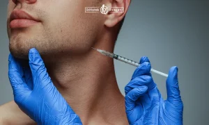 زاویه سازی فک با فیلر برای یک آقا