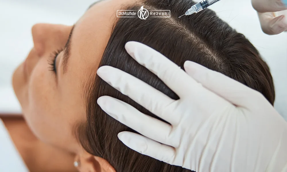 تزریق مزوتراپی مو به سر یک خانم | سن مناسب تزریق مزوتراپی مو