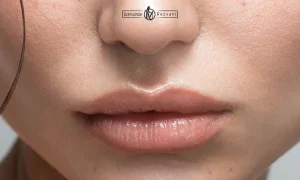  مدل ژل لب عروسکی یک دختر