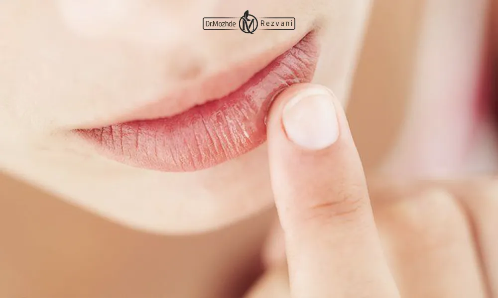 تصویر خشکی لب یک خانم