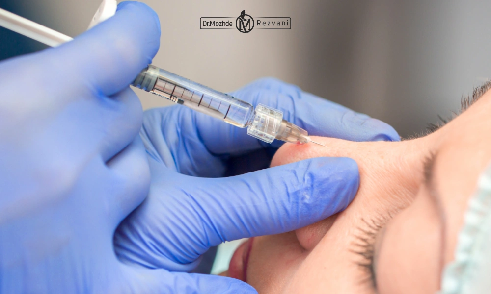 پزشکش در حین تزریق بوتاکس برای بیمار | نقتط تزریق بوتاکس بینی