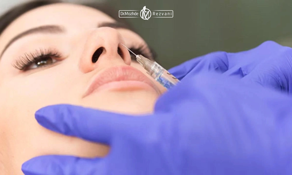 مشخص کردن نقاط تزریق بوتاکس بینی توسط پزشک 