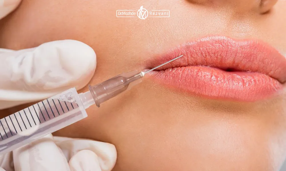تزریق ژل لب برای یک خانم زیبا جو