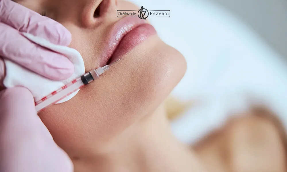 تزریق ژل لب برای یک خانم زیباجو