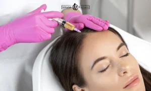 تزریق پی ار پی برای بیمار | مقایسه هیر فیلر با پی آر پی مو