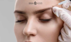 لیفت ابرو با بوتاکس توسط پزشک برای مراجعه کننده ی خانم