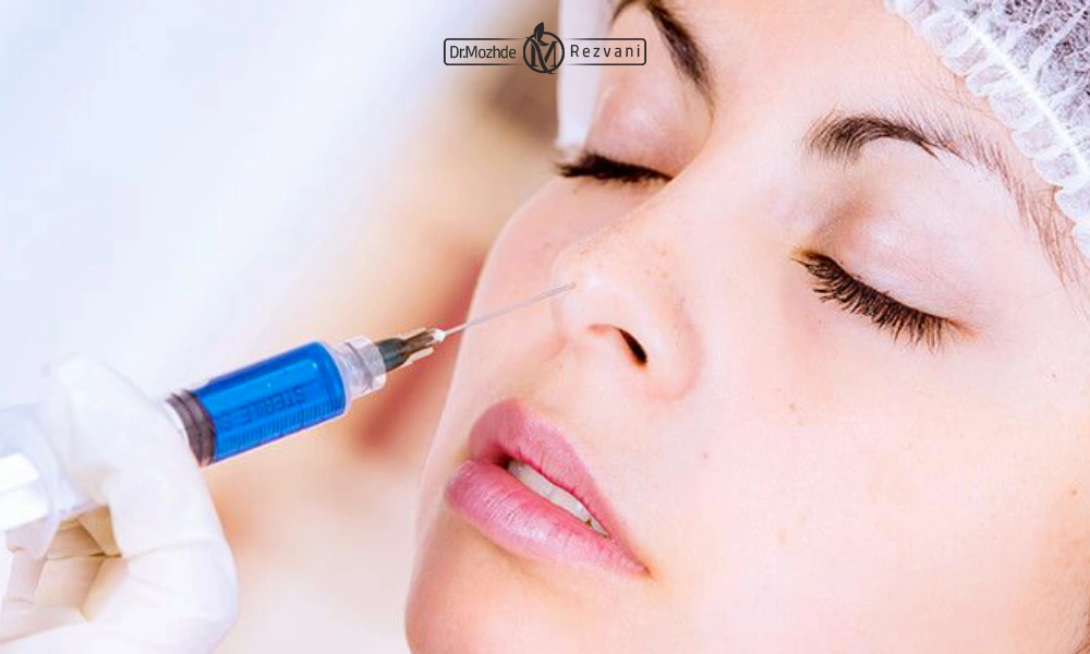 تزریق فیلر بینی | ماندگاری فیلر بینی