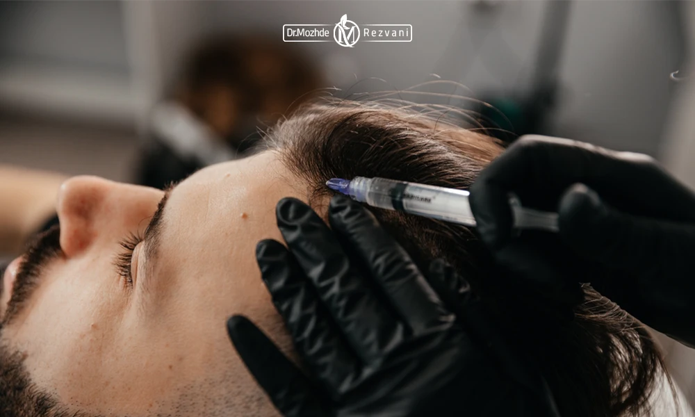 تزریق هیر فیلر برای یک اقا که دراز کشیده است | ماندگاری هیر فیلر 