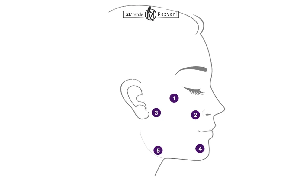 نقاط تزریق جالپرو به صورت