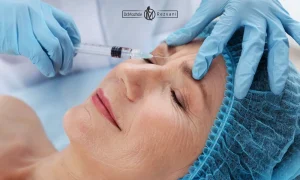 تزریق مزوژل پروفایلو به صورت یک خانم مسن | جالپرو یا پروفایلو