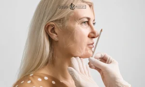 خانمی سن بالا اماده بریا لیفت با نخ | سن لیفت نخ