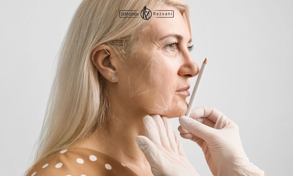 خانمی سن بالا اماده بریا لیفت با نخ | سن لیفت نخ