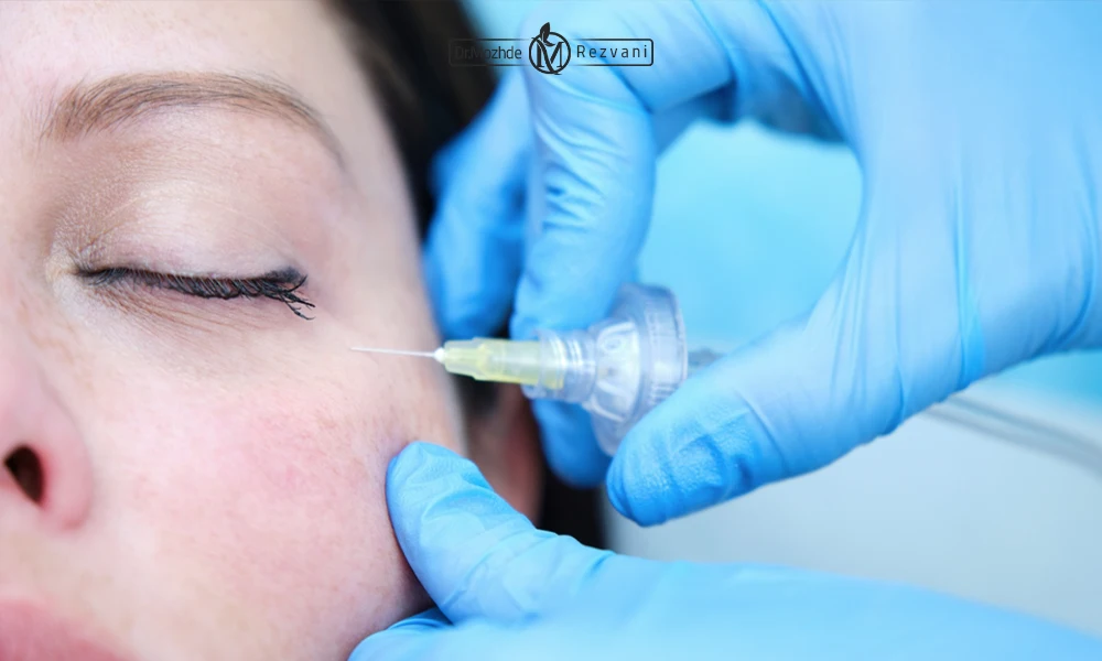 کربوکسی تراپی گودی زیر چشم 