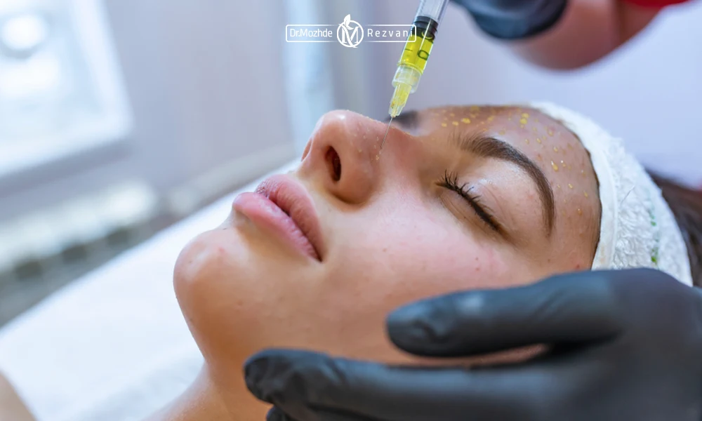 تاثیرات مزونیدلینگ