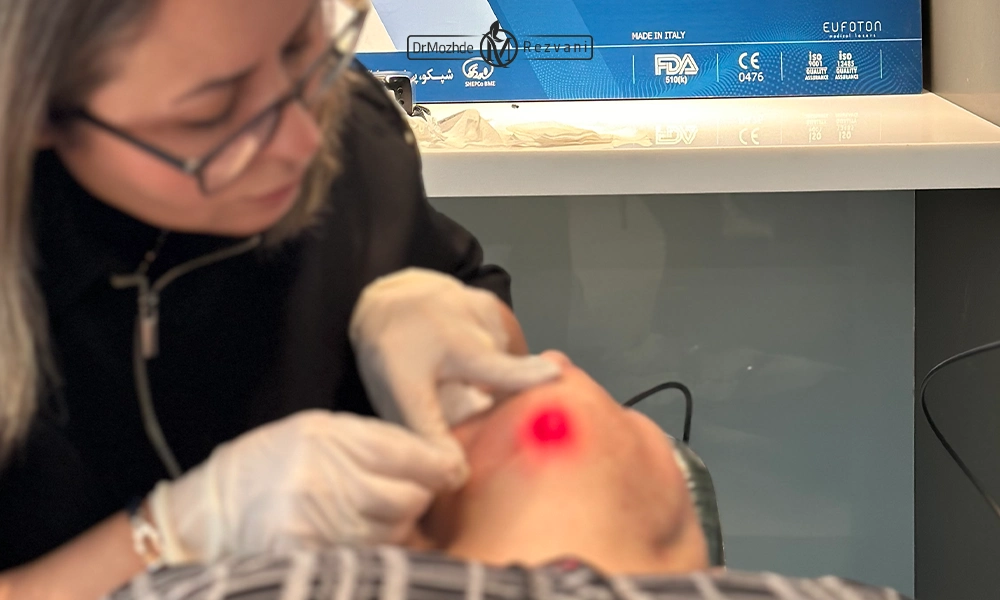 انجام اندولیفت غبفب توسط دکتر رضوانی