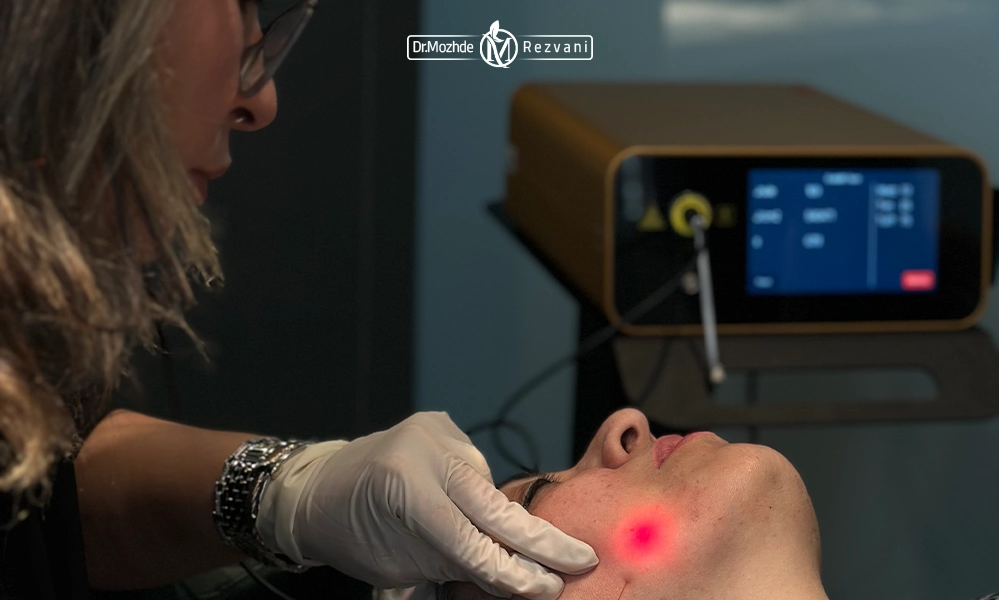 انجام اندولیفت توسط دکتر رضوانی