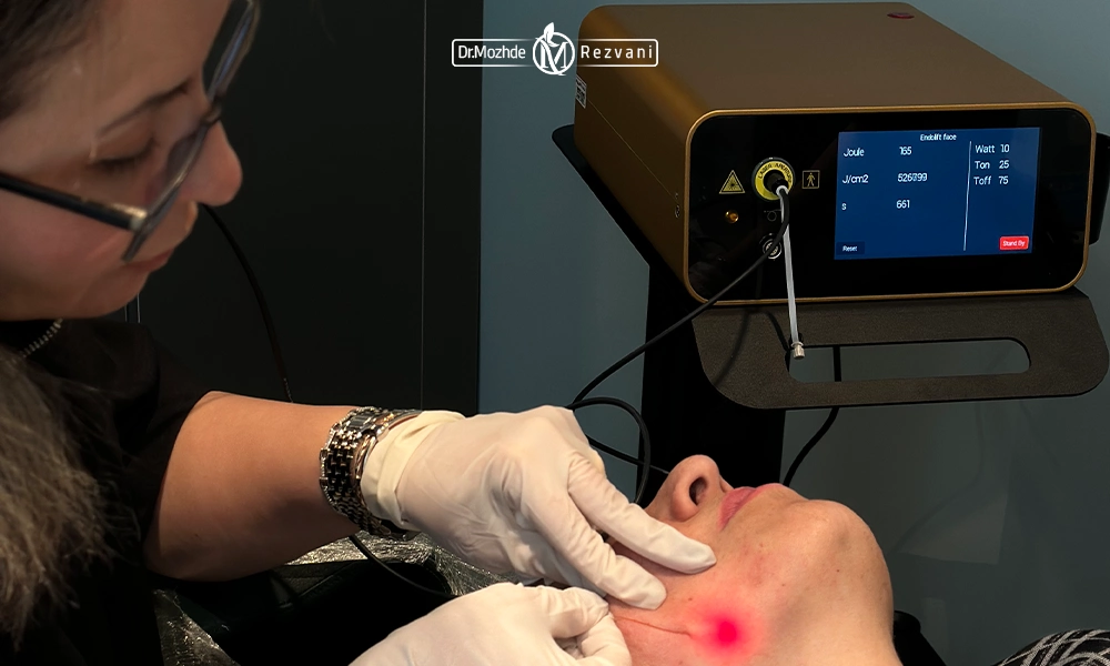 انجام اندولیفت توسط دکتر رضوانی