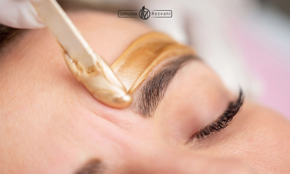 از بین بردن موهای زائد صورت با ماسک