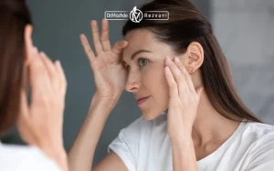 خانمی که در فکر انجام یکی از روش های جوانسازی پوست است | مقایسه اندولیفت و پروفایلو