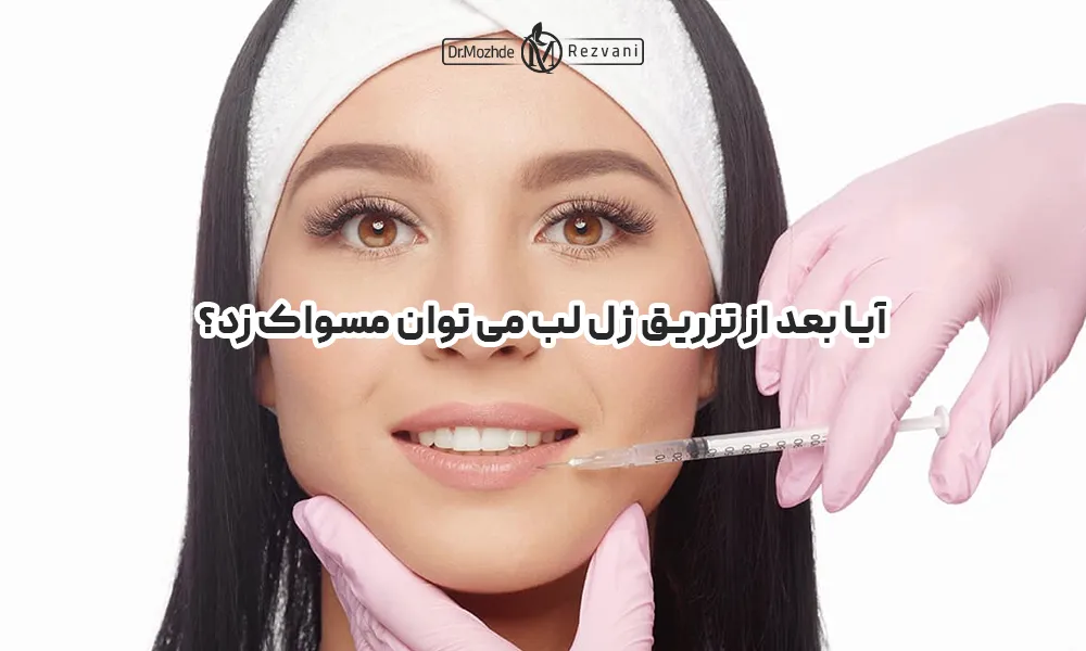 خانمی با لبخند و بستن هد بند در حال دریافت ژل لب به لب پایینی خود