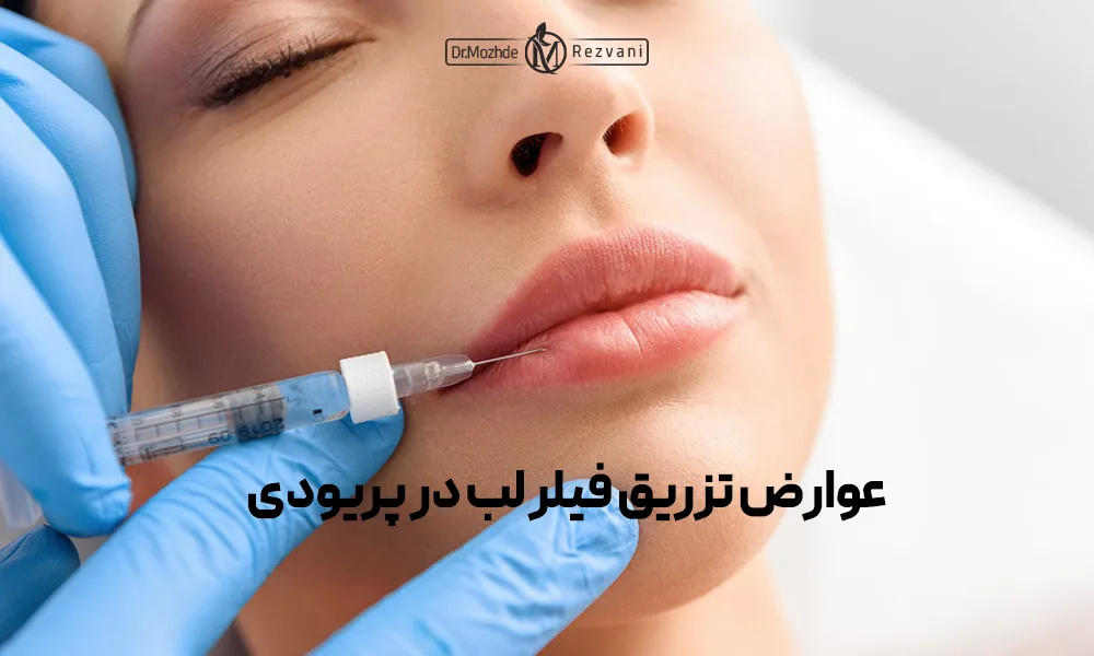 خانمی با چشمان بسته در حالتزریق فیلر لب در پریودی می باشد.