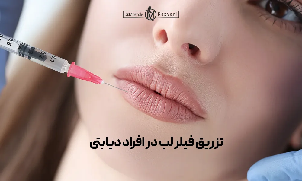 عکس از سه رخ خانمی در حال تزریق فیلر به لب پایینی خود | تزریق فیلر لب در پریودی
