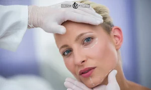 قبل از انجام اندولیفت در تهران، این نکات را حتماً بدانید