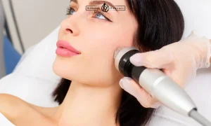 اندولیفت در تهران