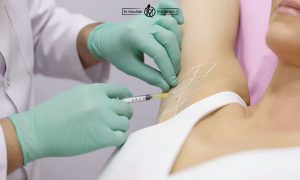 ۷ حقیقت جالب درباره بوتاکس زیر بغل که احتمالا نمی‌دانید